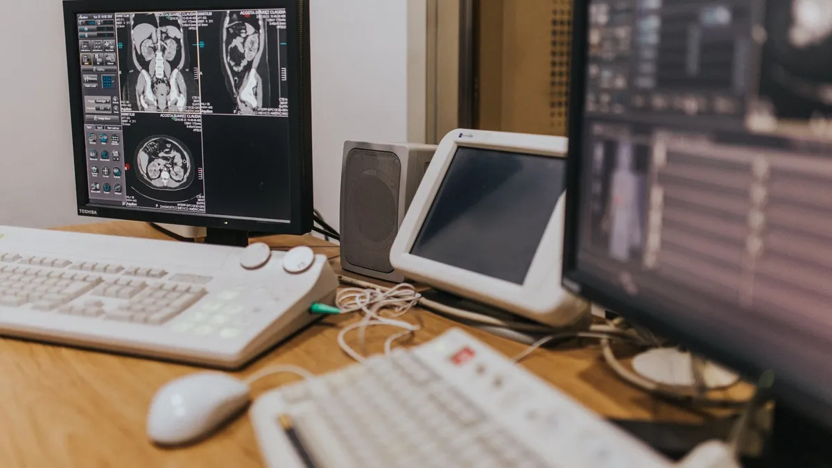 Medical imaging setup with MRI scans on multiple screens in a healthcare facility.